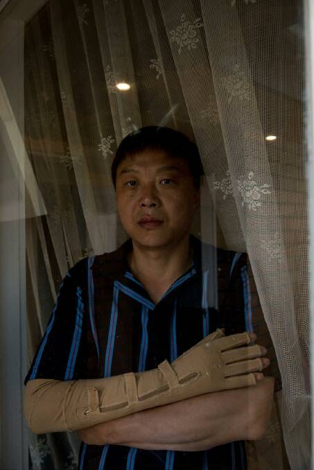 Injured: Chinese migrant Andy Zhang, whose arm was mangled in a work accident. Photo: Jesse Marlow