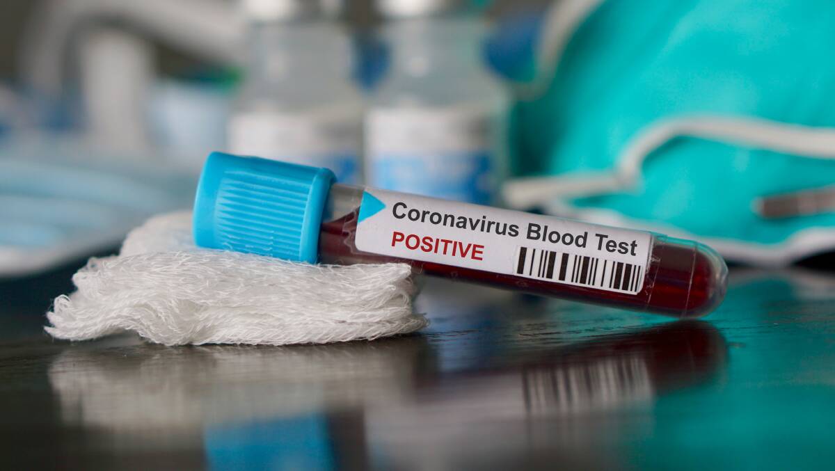 Another local has coronavirus, and 18 more to be tested following group holiday