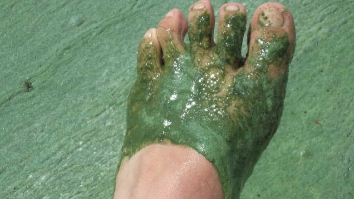 High alert warning for blue-green algae