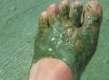 The species of blue-green algae identified are potentially toxic and may cause gastroenteritis in humans if consumed and skin and eye irritations after contact. Boiling the water does not remove algal toxins.